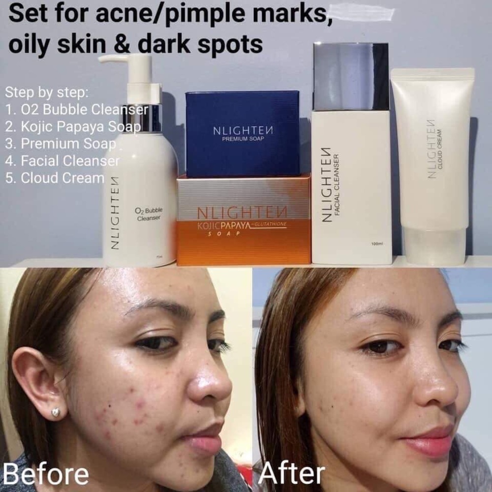 NLigthen Skin Care Product